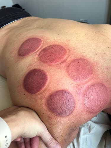 Sports Recovery Massage